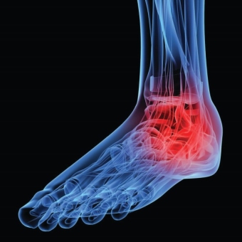 piede reumatoide,piede diabetico,artrite gottosa,ulcerazioni,tinea pedis,disidrosi ed iperidrosi modena
